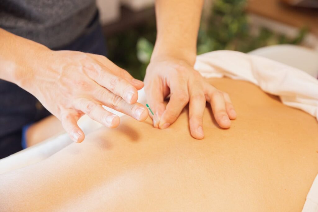 Terapias Naturais: Acupuntura | Foto de Ryutaro Tsukata: https://www.pexels.com/pt-br/foto/terapeuta-tratando-paciente-com-agulhas-durante-procedimento-de-medicina-alternativa-5473180/